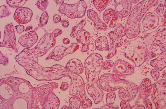 Placenta Villi